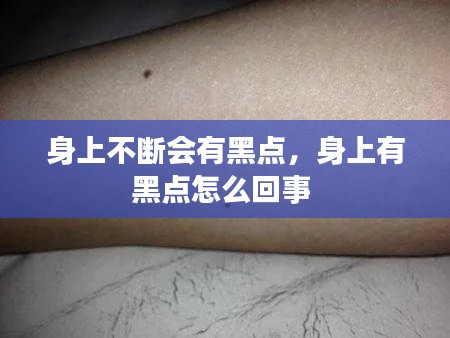 身上不断会有黑点，身上有黑点怎么回事 