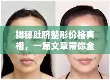 揭秘肚脐整形价格真相,一篇文章带你全面了解!